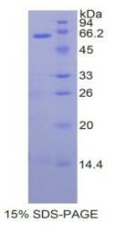 SDS-PAGE (TFPI-106H).jpg